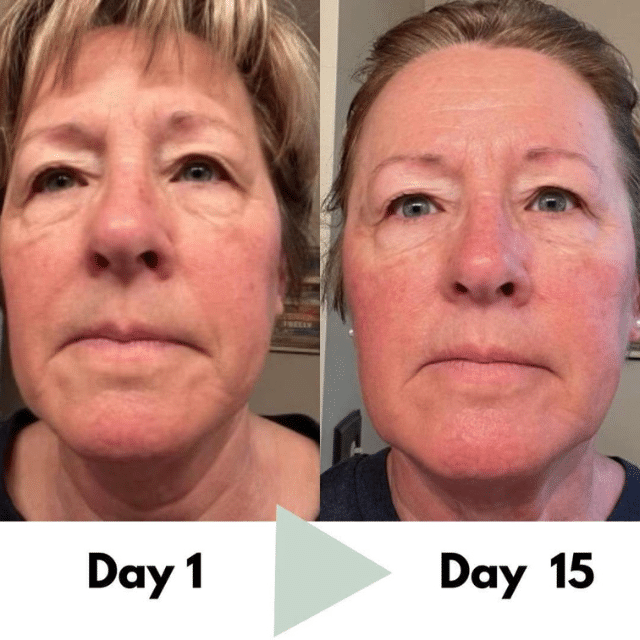 Age with grace and reverse aging with activated liquid collagen