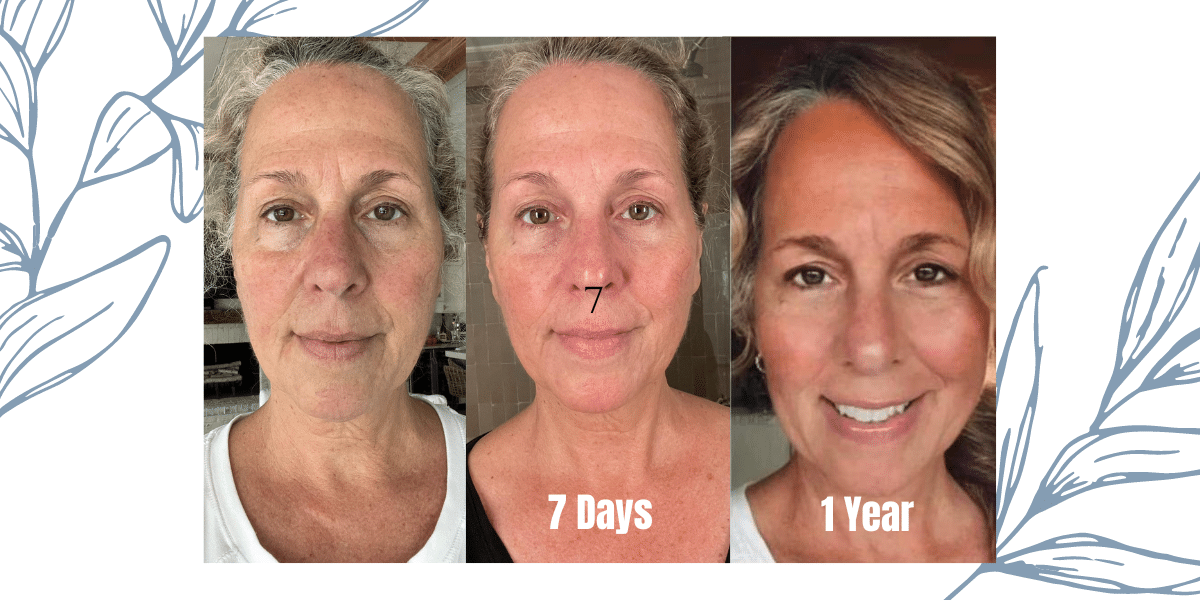 Anti-aging collagen products to look younger naturally.