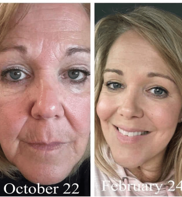 Anti-aging collagen products to look younger naturally.